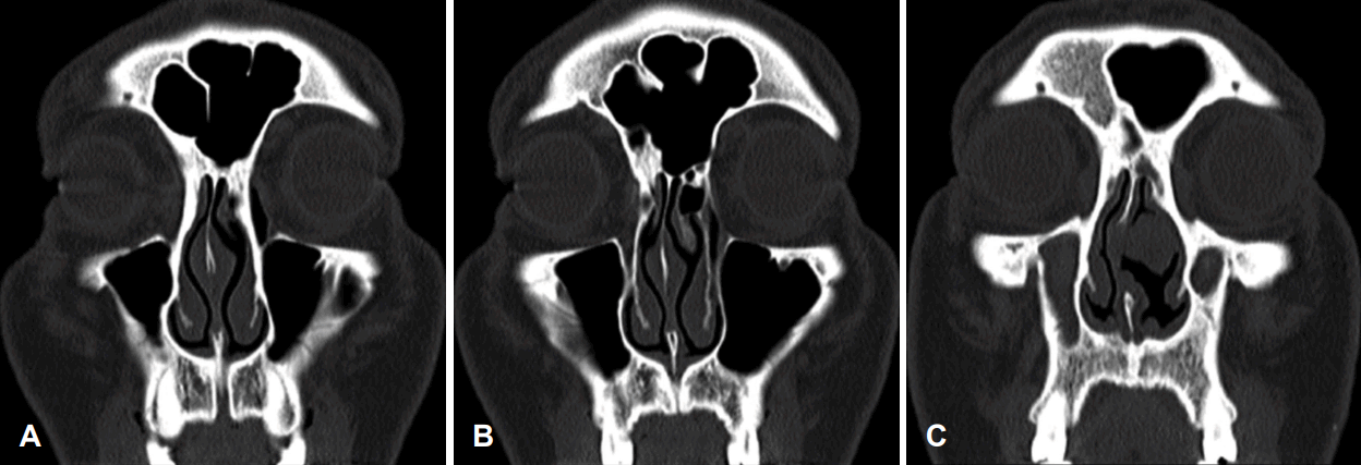 Fig. 2.