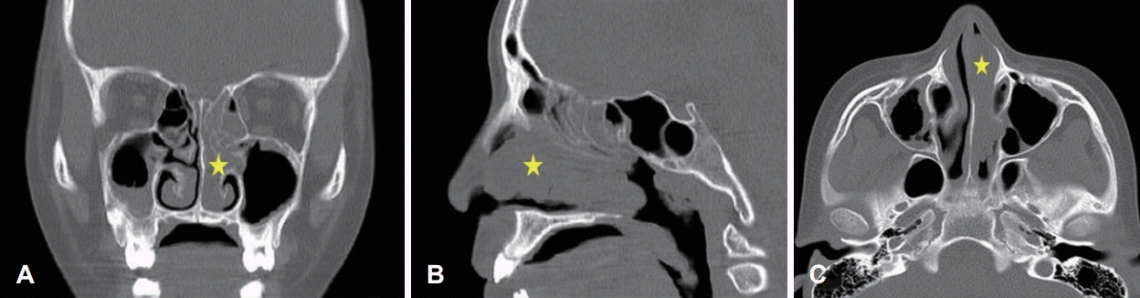 Fig. 9.