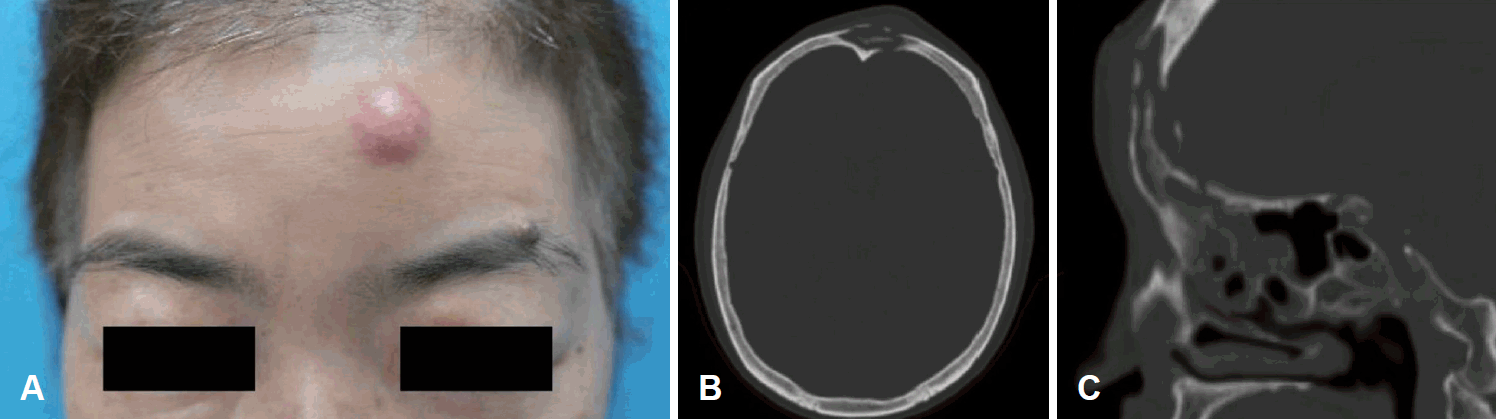 Fig. 2.