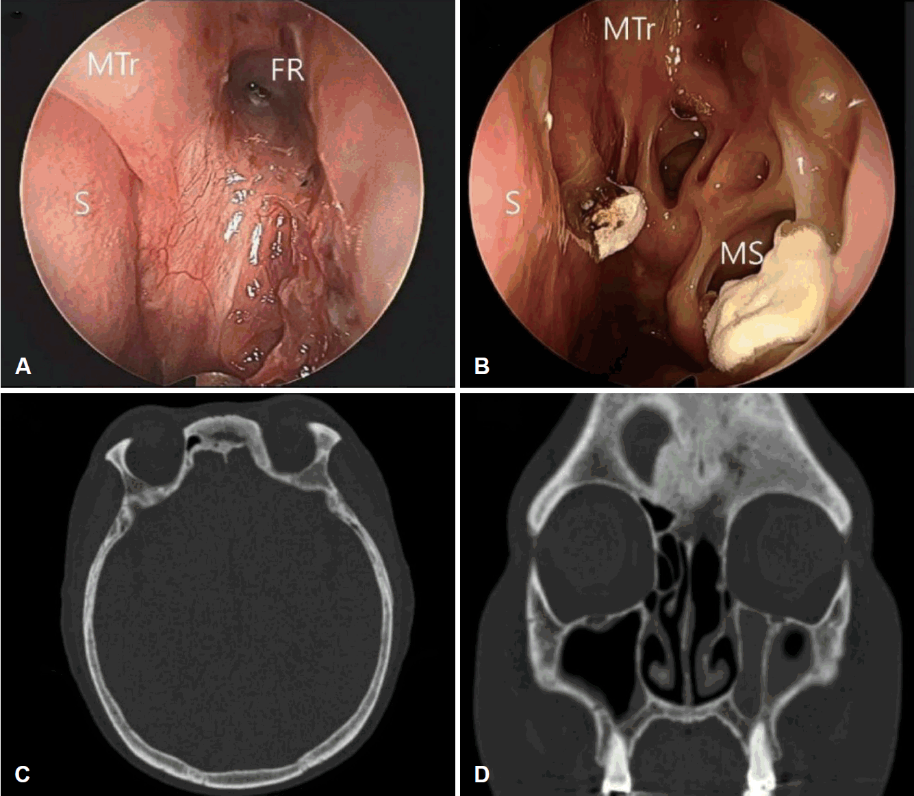 Fig. 5.