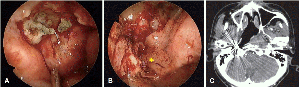 Fig. 6.