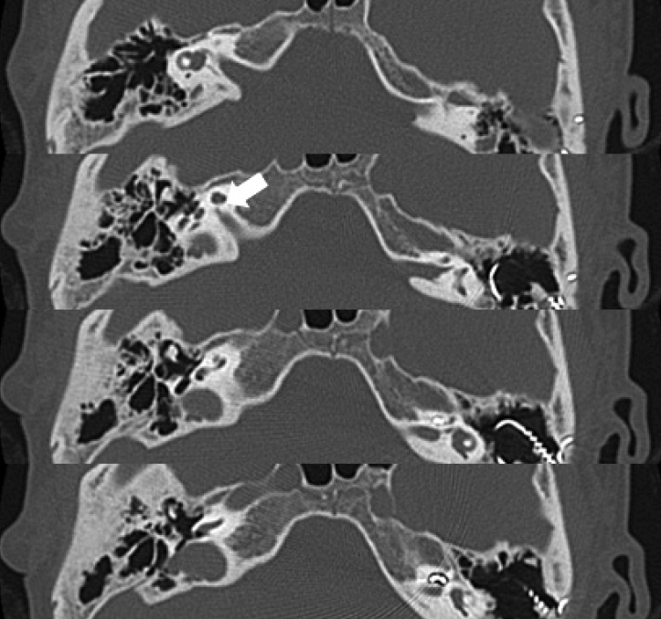 Fig. 2.