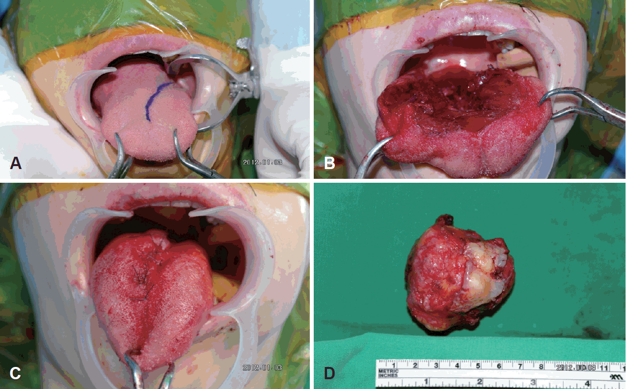Fig. 2.