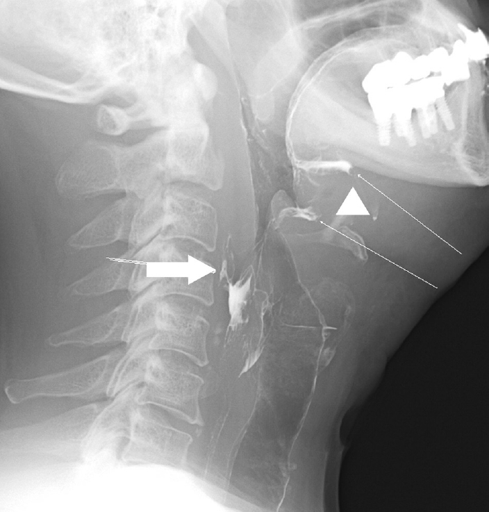 Fig. 7.