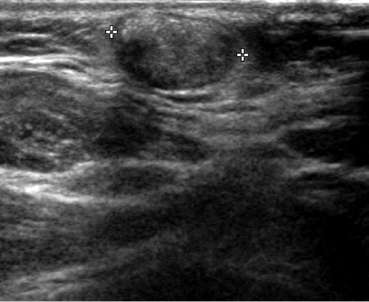 kjorl-hns-2021-00381f1.jpg