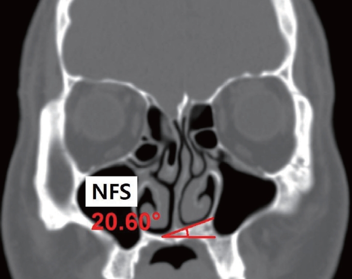 kjorl-hns-2021-00451f2.jpg