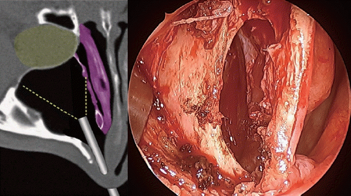 Fig. 2.