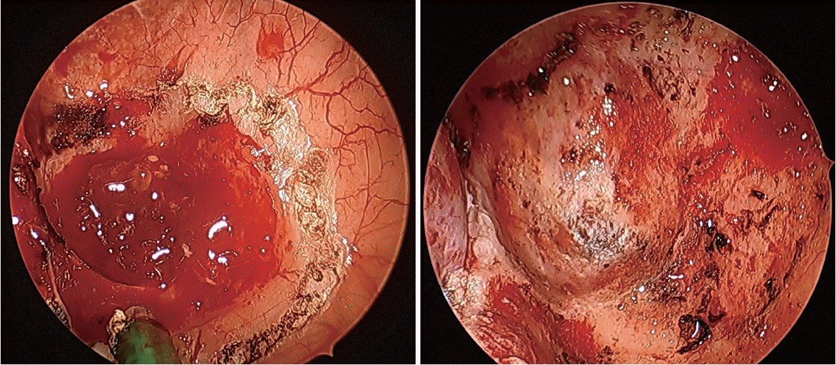 Fig. 6.