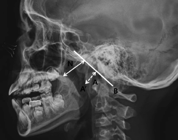 Fig. 2.