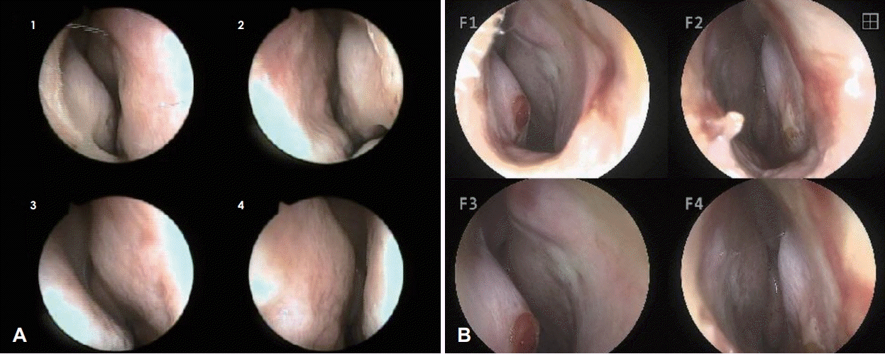 Fig. 3.