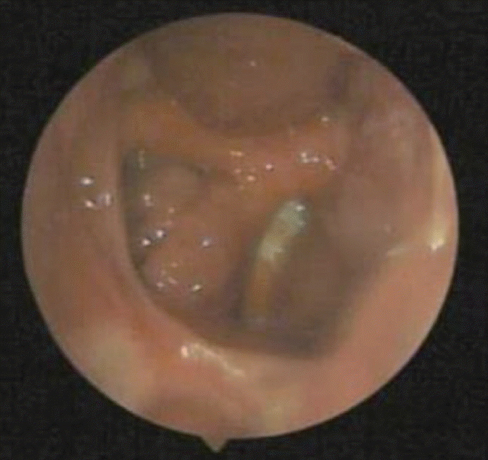 Fig. 5.
