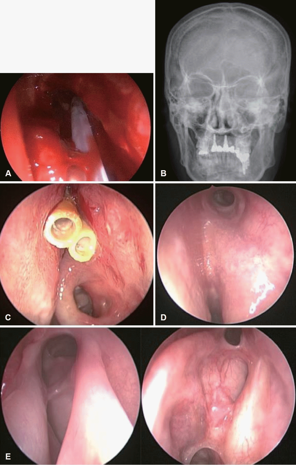 Fig. 2.