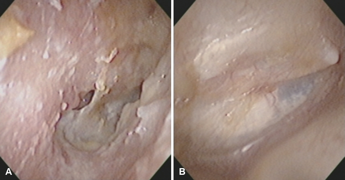 kjorl-hns-2025-00283f4.jpg