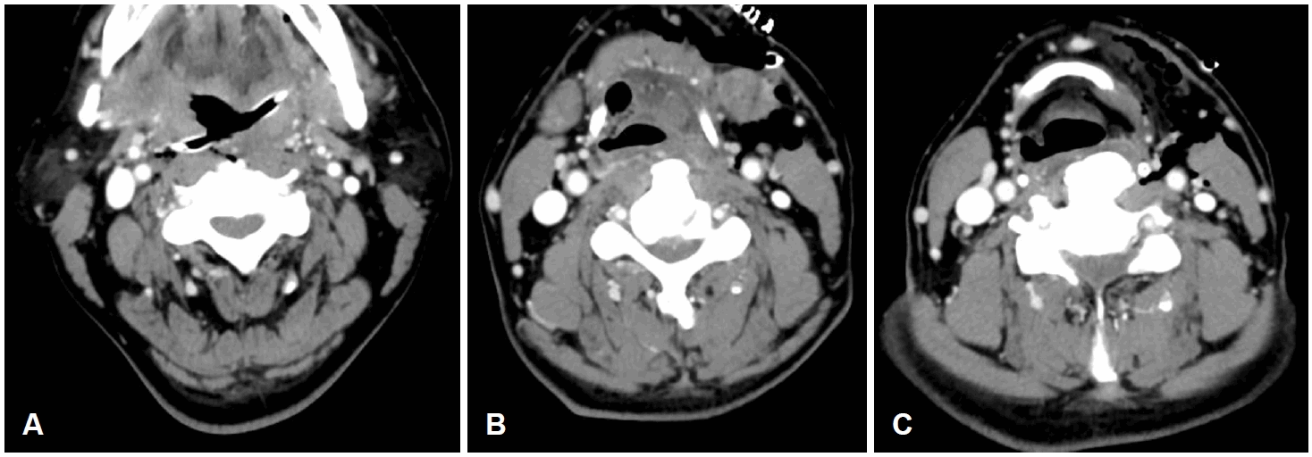 Fig. 2.