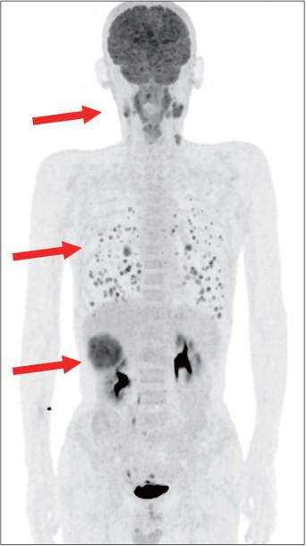 Fig. 5.