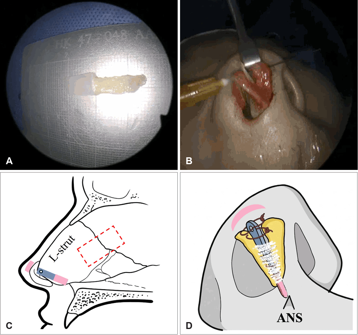 Fig. 2.