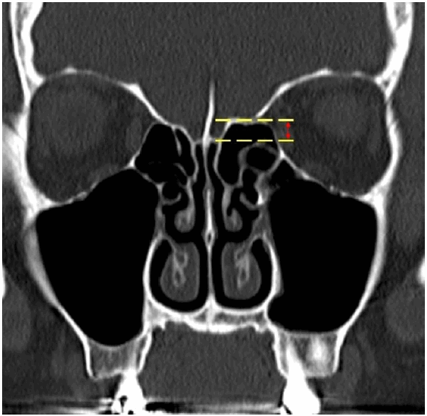 Fig. 1.