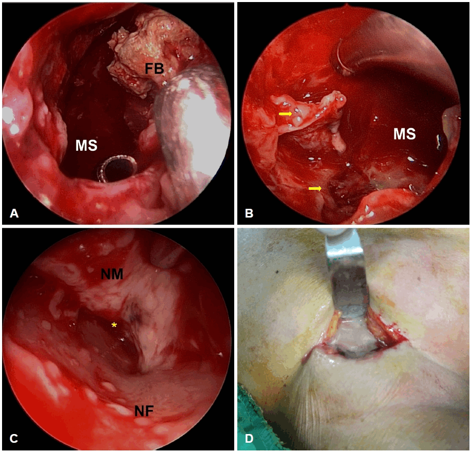 Fig. 4.