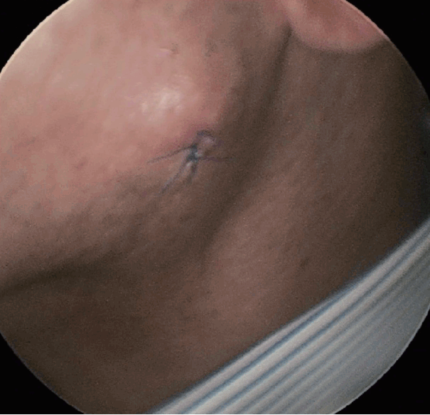 kjorl-hns-2016-17510f1.gif