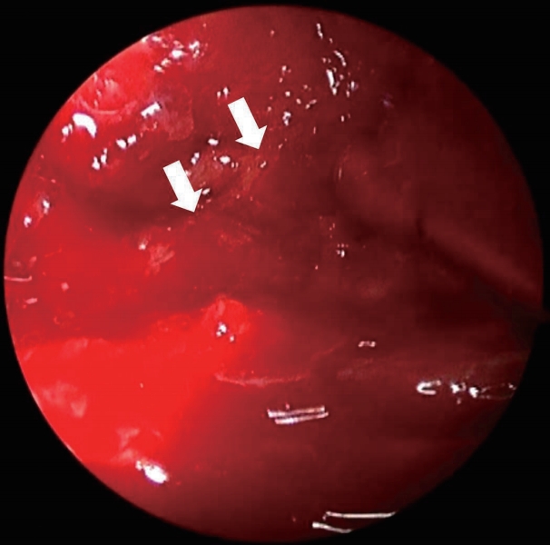 kjorl-hns-2019-00108f3.jpg