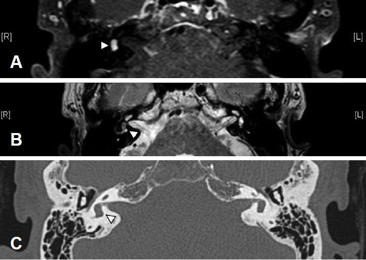 kjorl-hns-2019-00598f2.jpg